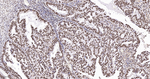 Pokemon Antibody in Immunohistochemistry (Paraffin) (IHC (P))
