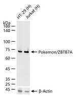 Pokemon Antibody in Western Blot (WB)