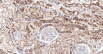 TrxR2 Recombinant Rabbit Monoclonal Antibody (3D5)