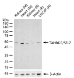 TrxR2 Antibody in Western Blot (WB)