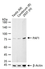 PAF1 Antibody in Western Blot (WB)