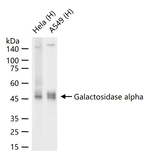 alpha Galactosidase Antibody in Western Blot (WB)
