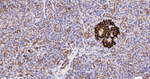 TSC1 Antibody in Immunohistochemistry (Paraffin) (IHC (P))