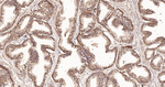 TSC1 Antibody in Immunohistochemistry (Paraffin) (IHC (P))