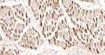 TSC1 Antibody in Immunohistochemistry (Paraffin) (IHC (P))
