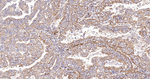 TSC1 Recombinant Rabbit Monoclonal Antibody (1F10)