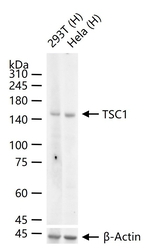 TSC1 Antibody in Western Blot (WB)