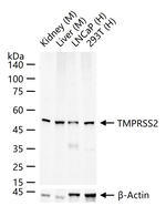 TMPRSS2 Antibody in Western Blot (WB)