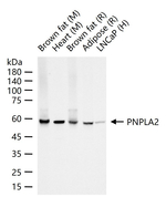 ATGL Recombinant Rabbit Monoclonal Antibody (4E14)