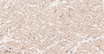 LGR6 Antibody in Immunohistochemistry (Paraffin) (IHC (P))