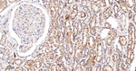LGR6 Antibody in Immunohistochemistry (Paraffin) (IHC (P))