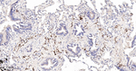 LGR6 Antibody in Immunohistochemistry (Paraffin) (IHC (P))