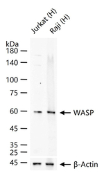WASP Recombinant Rabbit Monoclonal Antibody (7H7)