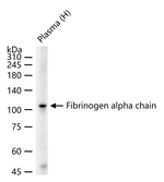 Fibrinogen alpha chain Antibody in Western Blot (WB)