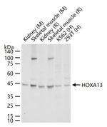 HOXA13 Recombinant Rabbit Monoclonal Antibody (19F13)