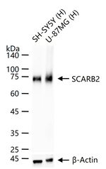 LIMP2 Antibody in Western Blot (WB)