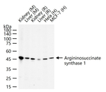 ASS1 Antibody in Western Blot (WB)
