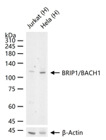 BRIP1 Recombinant Rabbit Monoclonal Antibody (5C2)
