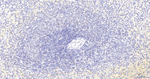SMCHD1 Antibody in Immunohistochemistry (Paraffin) (IHC (P))