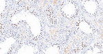 SMCHD1 Antibody in Immunohistochemistry (Paraffin) (IHC (P))