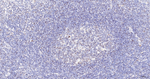 SMCHD1 Antibody in Immunohistochemistry (Paraffin) (IHC (P))