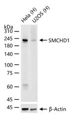 SMCHD1 Antibody in Western Blot (WB)