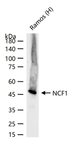 p47phox Recombinant Rabbit Monoclonal Antibody (2C20)