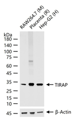 TIRAP Recombinant Rabbit Monoclonal Antibody (4F11)