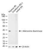 Adenosine Deaminase Recombinant Rabbit Monoclonal Antibody (3B7)