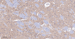 CHRM2 Recombinant Rabbit Monoclonal Antibody (12G9)