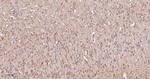 CHRM2 Antibody in Immunohistochemistry (Paraffin) (IHC (P))
