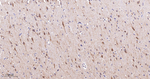 CHRM2 Antibody in Immunohistochemistry (Paraffin) (IHC (P))