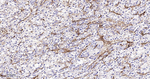 HLA-B Antibody in Immunohistochemistry (Paraffin) (IHC (P))