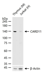 CARD11 Antibody in Western Blot (WB)