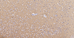 MUNC18 Antibody in Immunohistochemistry (Paraffin) (IHC (P))