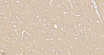 MUNC18 Antibody in Immunohistochemistry (Paraffin) (IHC (P))