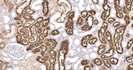 GGT1 Recombinant Rabbit Monoclonal Antibody (4B10)