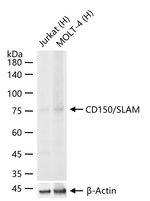 CD150 Recombinant Rabbit Monoclonal Antibody (6D11)