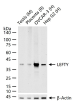 LEFTY Recombinant Rabbit Monoclonal Antibody (7D6)
