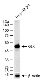 GCK Recombinant Rabbit Monoclonal Antibody (8A5)