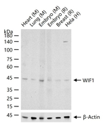 WIF1 Recombinant Rabbit Monoclonal Antibody (10A1)