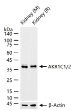 AKR1C1/AKR1C2 Recombinant Rabbit Monoclonal Antibody (8B2)