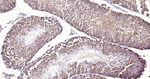 PSAP Antibody in Immunohistochemistry (Paraffin) (IHC (P))