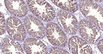 PSAP Antibody in Immunohistochemistry (Paraffin) (IHC (P))