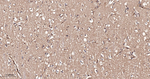 PLCG2 Antibody in Immunohistochemistry (Paraffin) (IHC (P))