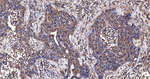 PLCG2 Antibody in Immunohistochemistry (Paraffin) (IHC (P))