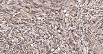 PLCG2 Antibody in Immunohistochemistry (Paraffin) (IHC (P))