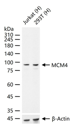 MCM4 Antibody in Western Blot (WB)