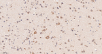 TMEFF2 Antibody in Immunohistochemistry (Paraffin) (IHC (P))