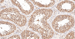 TMEFF2 Antibody in Immunohistochemistry (Paraffin) (IHC (P))